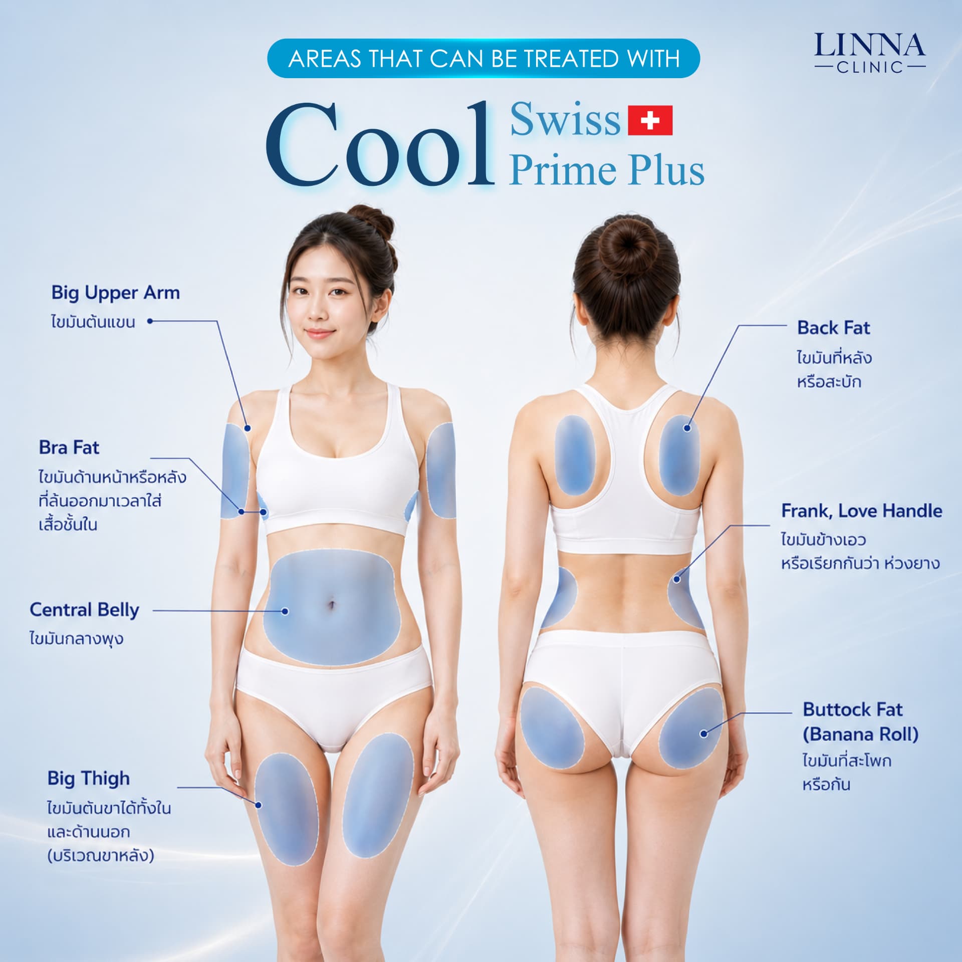 Treatment areas for Cool Swiss Prime Plus