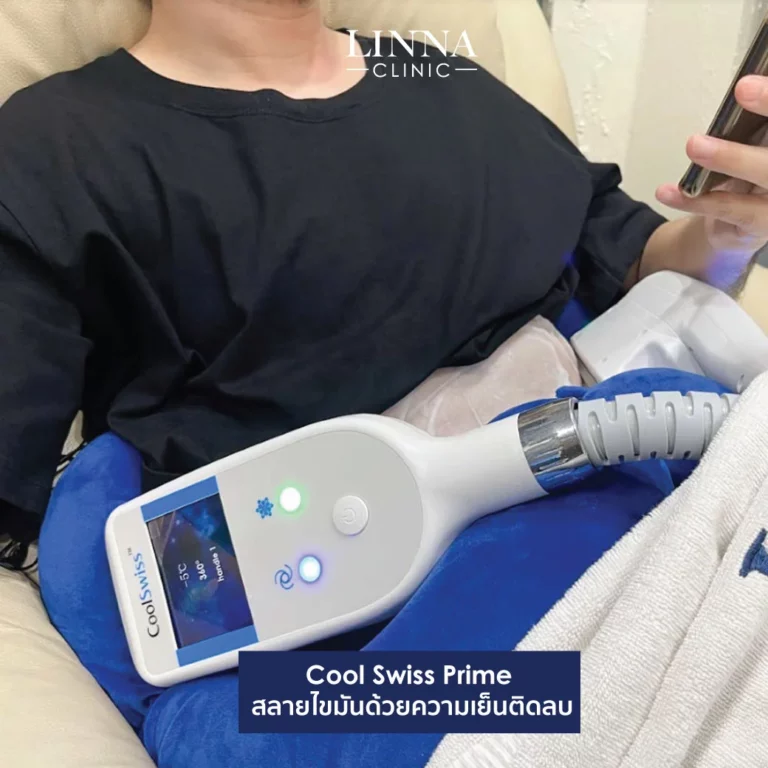 Cool Swiss Prime Plus treatment experience