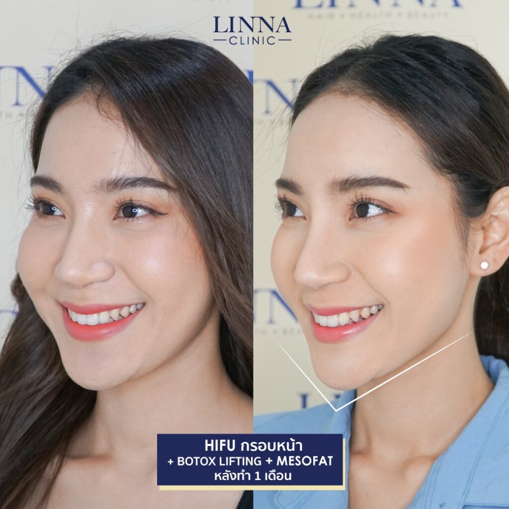 Dr. Phrutphailin Tantisinlaphong, M.D. — 5