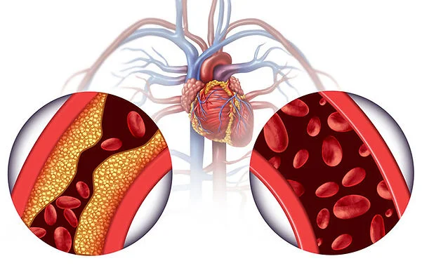 Chelation