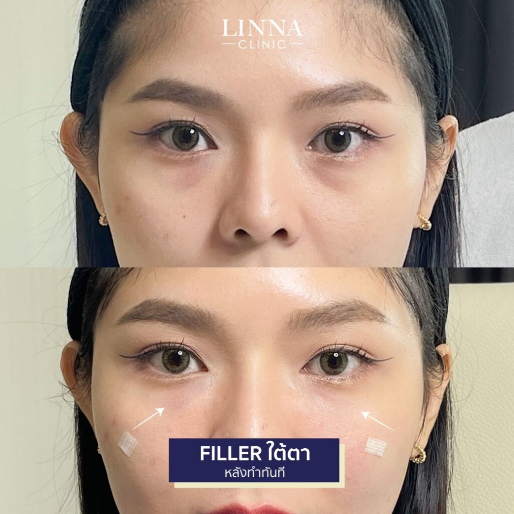 Dr. Phrutphailin Tantisinlaphong, M.D. — 10