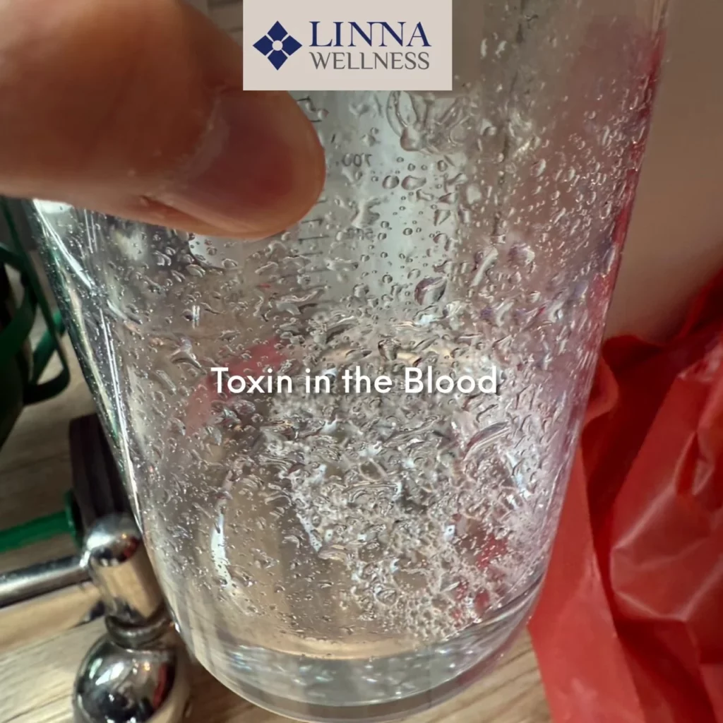 Ozone Therapy (EBOO PLUS Technique) at LINNA Clinic