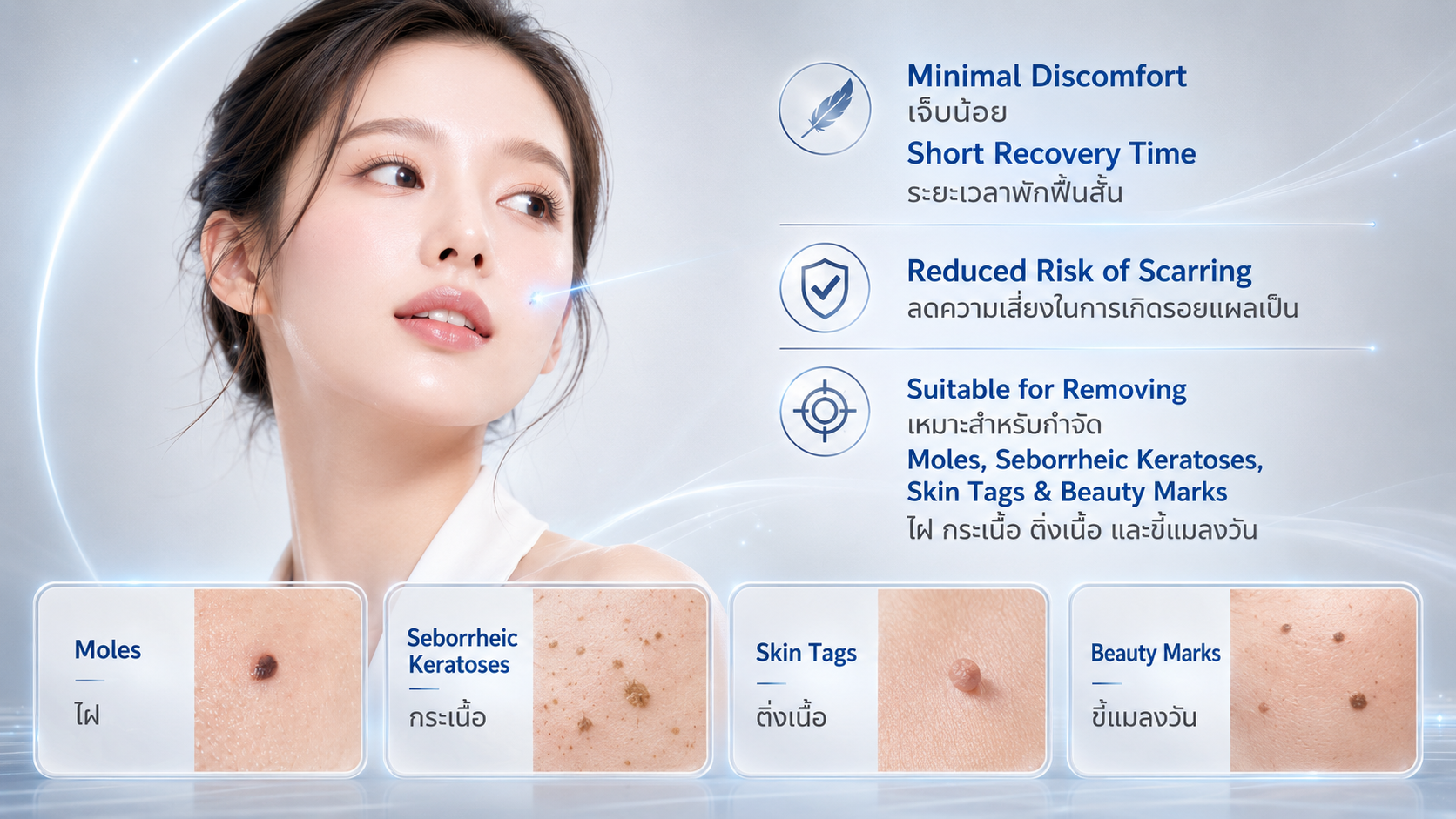 LINNA Co2 Laser at LINNA Clinic