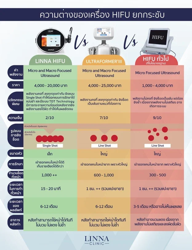 11 ข้อควรรู้ก่อนทำไฮฟู่ (Hifu) การรักษาความงามแบบไม่ต้องผ่าตัด