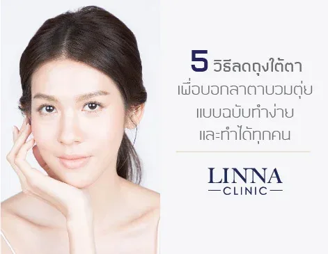 5 วิธีลดถุงใต้ตา บอกลาตาบวมตุ่ยฉบับง่ายและทำได้ทุกคน