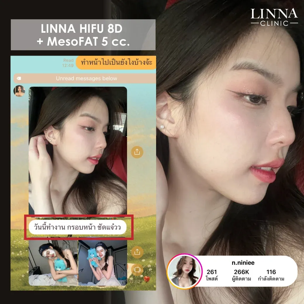 ฤกษ์ศัลยกรรม 2567 ฤกษ์ทำสวย เปิดวันดีประจำปี 2567 ที่เหมาะกับการทำสวย