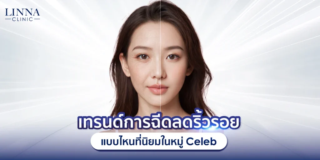 เทรนด์การฉีดลดริ้วรอย แบบไหนที่นิยมในหมู่ Celeb