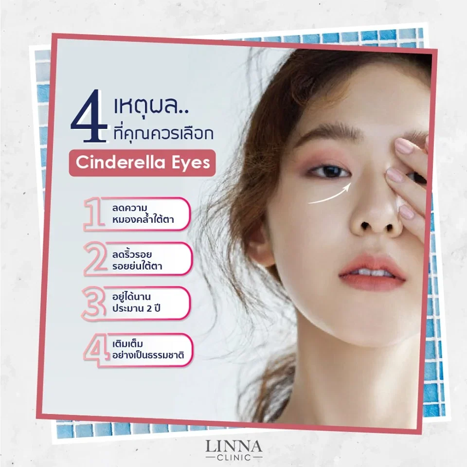 Cinderella Eyes ตัวเลือกใหม่สำหรับคนมีปัญหารอยคล้ำใต้ตา