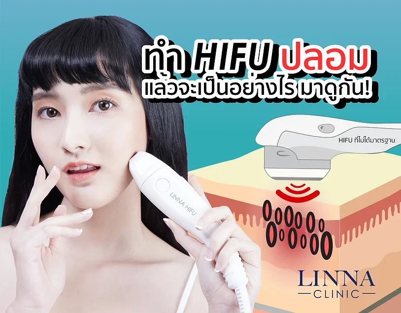 ทำ HIFU ปลอมแล้วจะเป็นอย่างไร มาดูกัน