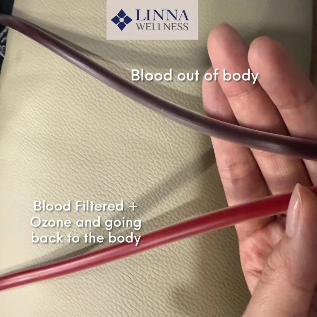 FAQ about EBOO Therapy: Frequently Asked Questions Before Making a Decision