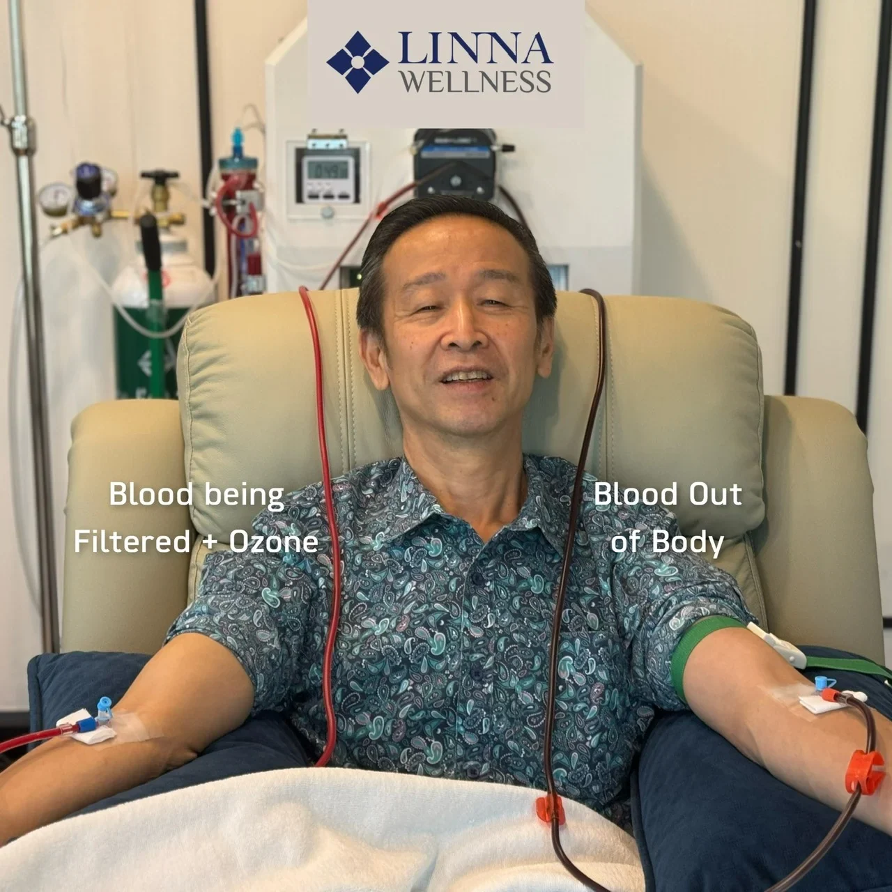 FAQ about EBOO Therapy: Frequently Asked Questions Before Making a Decision