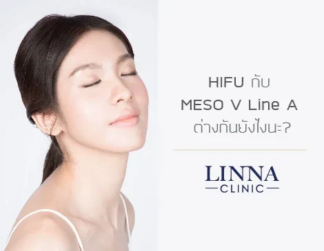 HIFU กับ MESO V Line A ต่างกันยังไงนะ