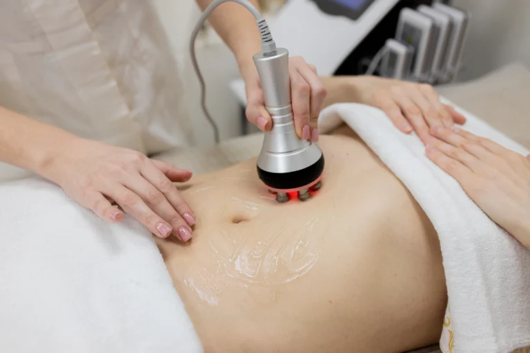 LINNA Body Sculpting by iCOONE® at LINNA Clinic