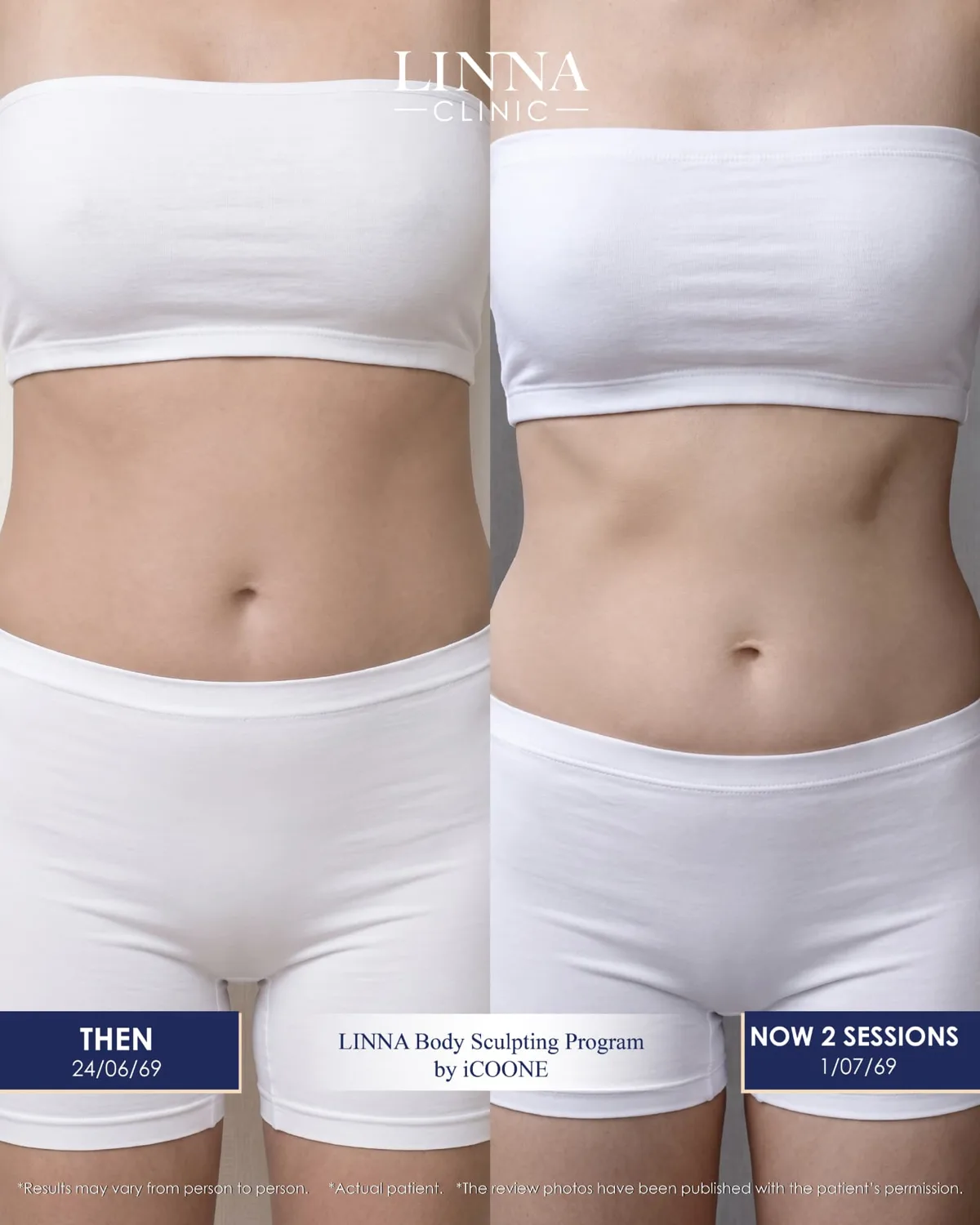LINNA Body Sculpting by iCOONE® at LINNA Clinic