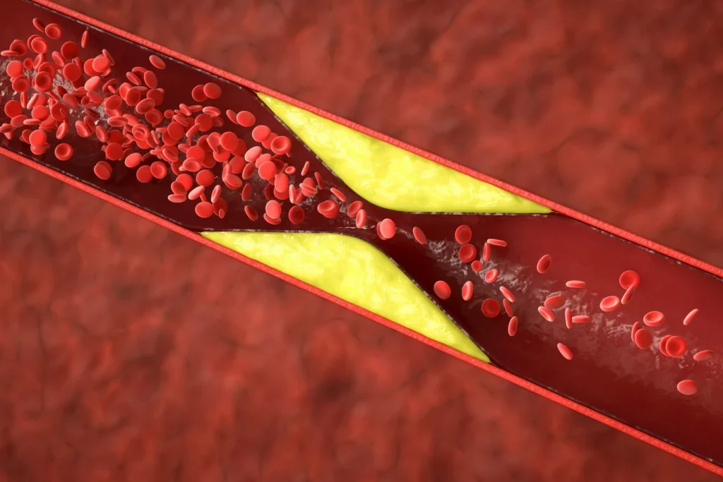 ما هو Plasma Exchange؟ تبديل البلازما لدعم الصحة: الفوائد والاحتياطات