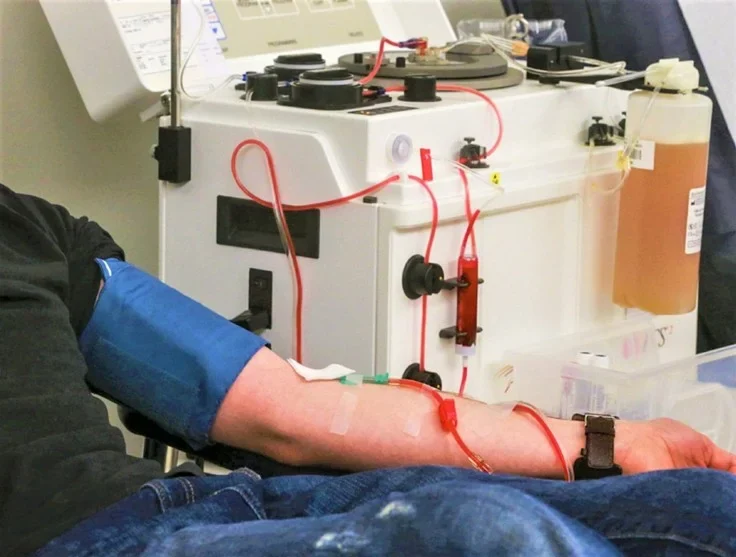 Comparison of Double Filtration Plasmapheresis and EBOO Therapy health-recovery programs