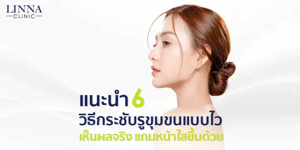 แนะนำ 6 วิธีกระชับรูขุมขนแบบไว เห็นผลจริง แถมหน้าใสขึ้นด้วย