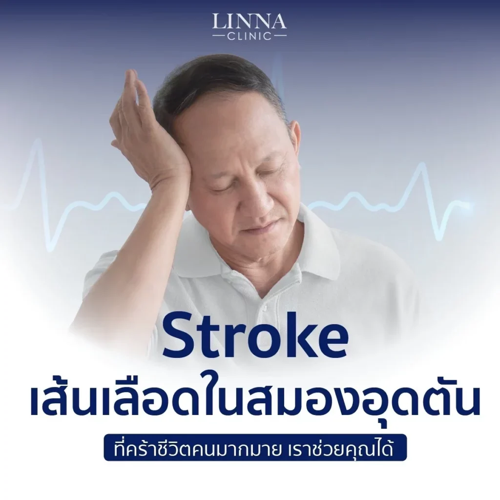 โรค Stroke คืออะไร? สาเหตุ อาการของโรค และวิธีป้องกัน