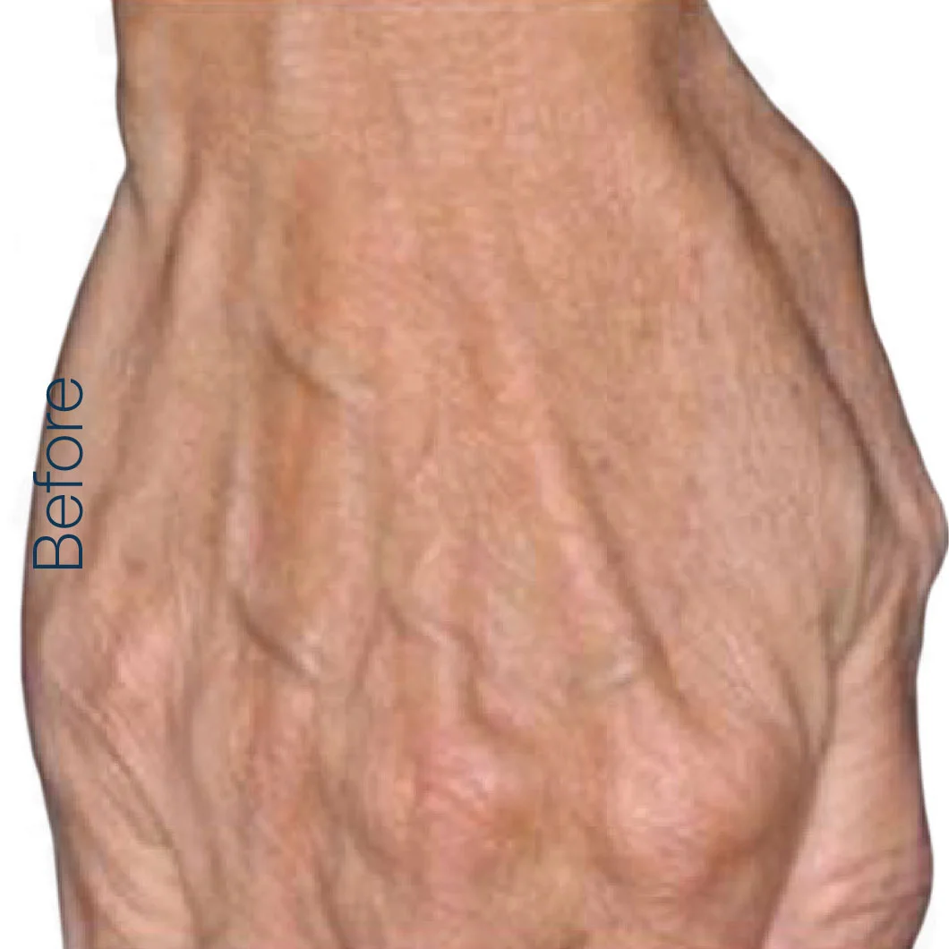 hand-before