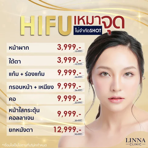 Promotion HIFU เหมาจุด แบบไม่จำกัด Shot