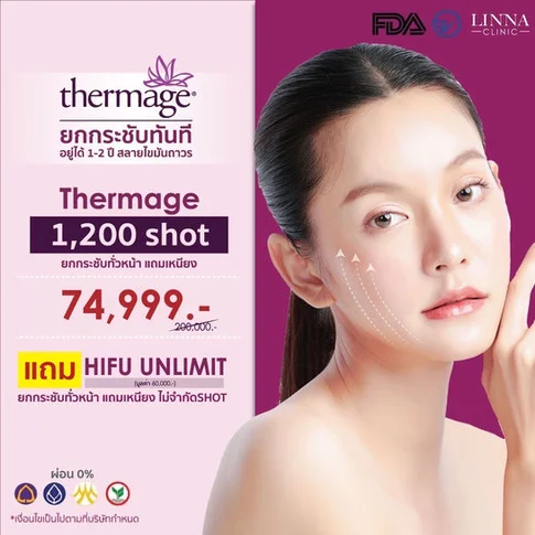 Promotion Thermage ยกกระชับทันที อยู่ได้ 1-2 ปี สลายไขมันถาวร