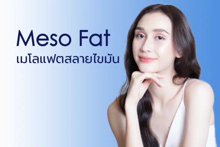 LINNA Clinic Mesofat ลดสัดส่วนต่าง ๆ บนร่างกาย ทำหน้าเรียว ฉีดลดแก้ม เหนียง ต้นแขน ต้นขา น่อง สะโพก ไขมันในบางจุด