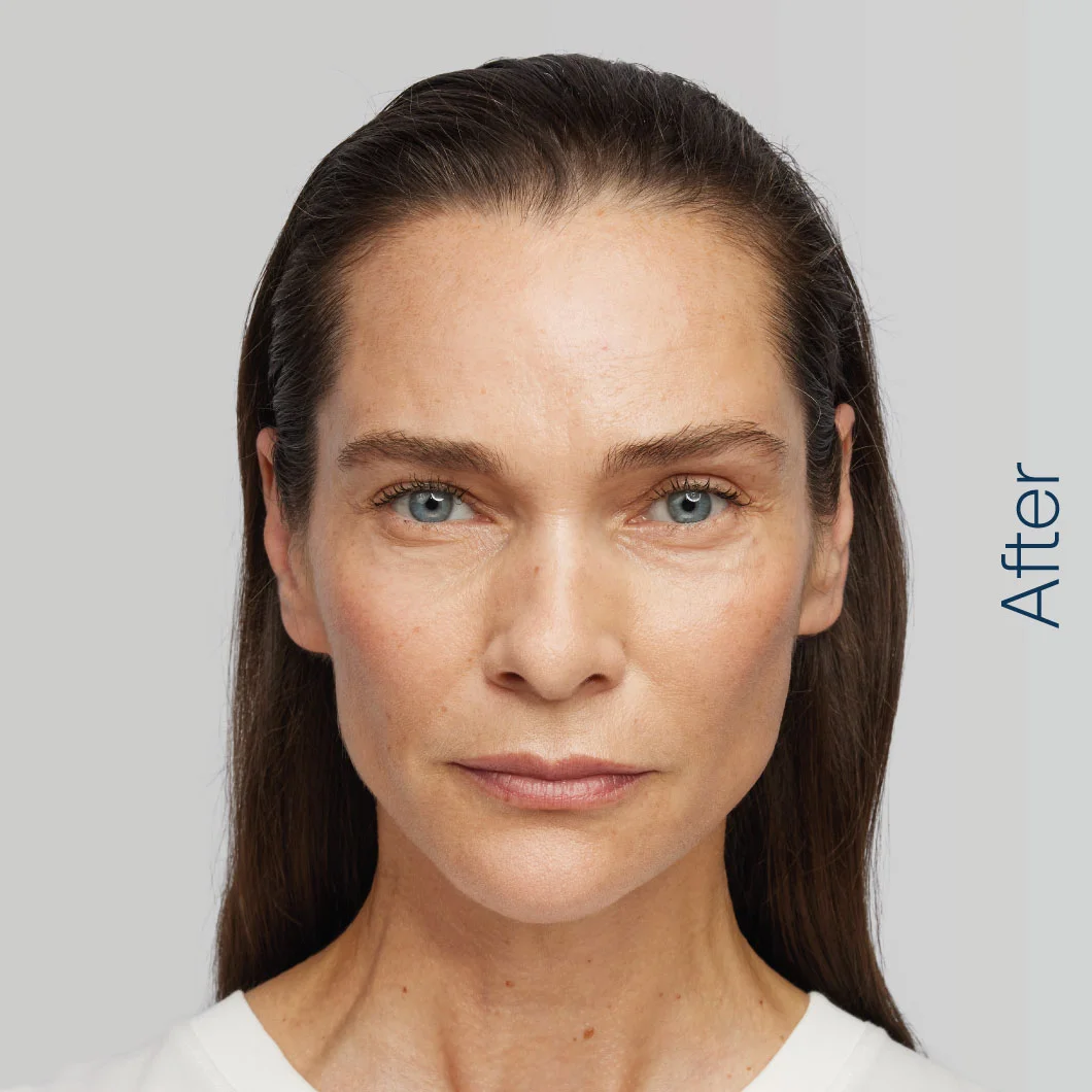 ewa-after