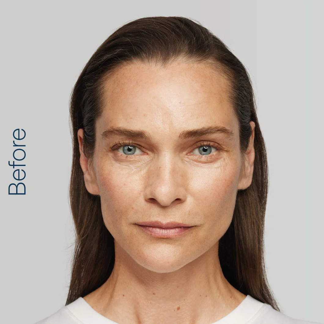 ewa-before