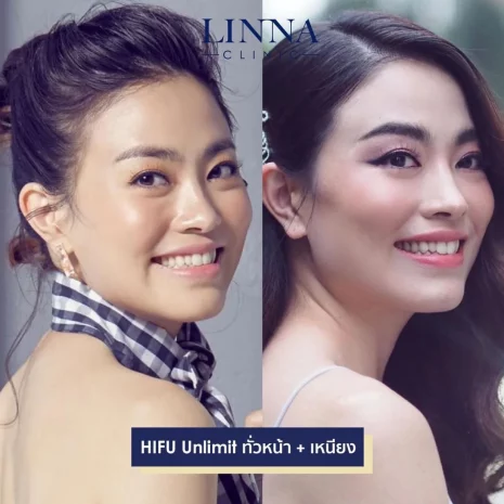 คุณแพรว DJ