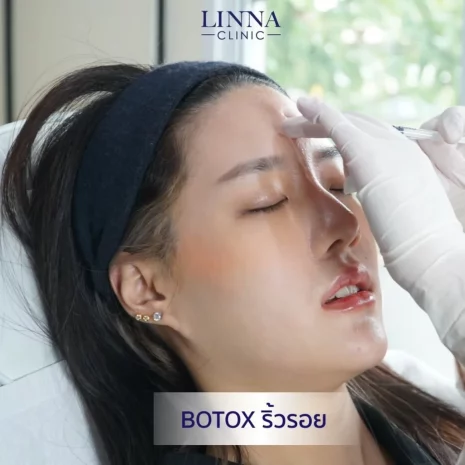 Review Botox